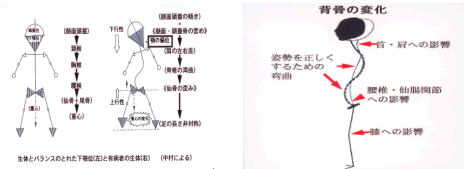 背骨の変化
