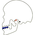 スプリントで矯正・診断